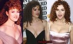 Bernadette Peters Plastic Surgery, Before and After Facelift