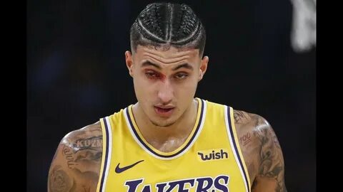 Kyle Kuzma BLEEDING from his eye after getting elbowed vs Th