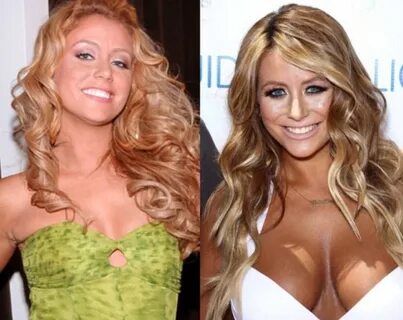 Is Aubrey O’Day Plastic Surgery’s Denial Able to Cover What 