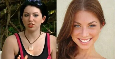 Stassi Schroeder Before Chin Implant Chin implant, Chin, Imp