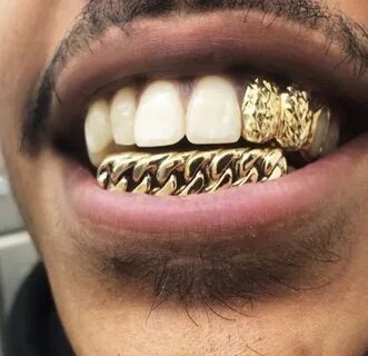 オ マ リ : Photo Gold teeth grills, Teeth jewelry, Grillz teeth