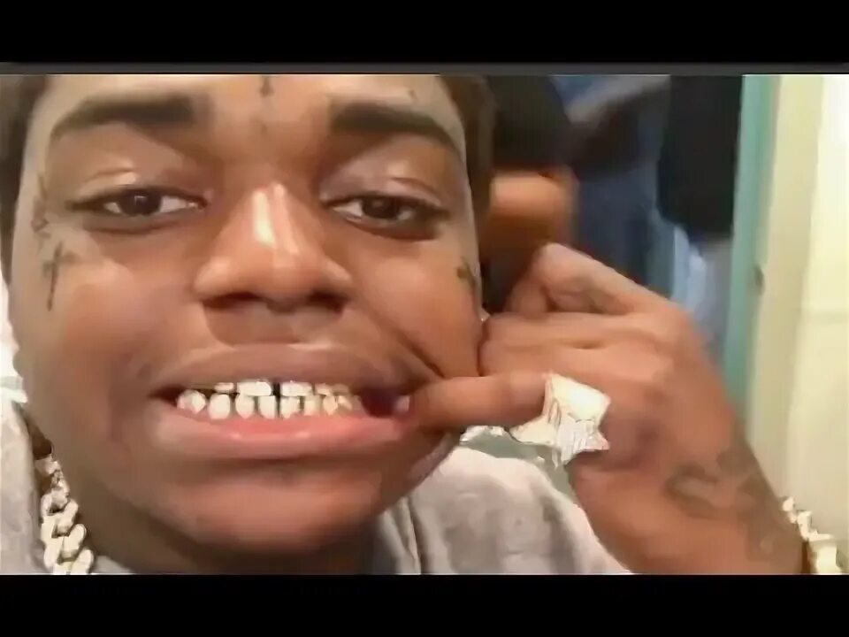 Kodak Black Not FEELING his White Teeth Gets New ICED OUT GR