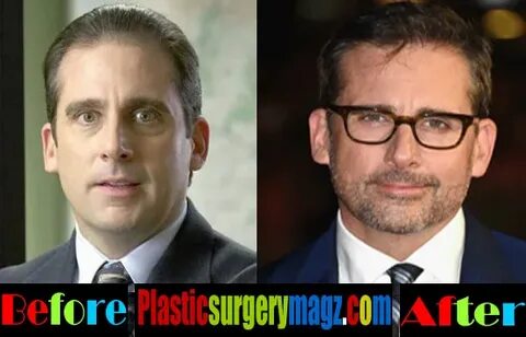 Steve Carell Plastic Surgery: Hair Transplant Plastic Surger
