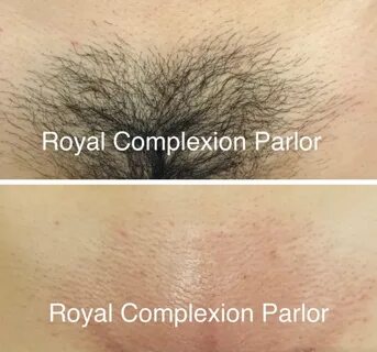 Schedule Appointment with Royal Complexion Parlor