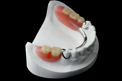 Протезирование нижней челюсти при отсутствии жевательных зуб