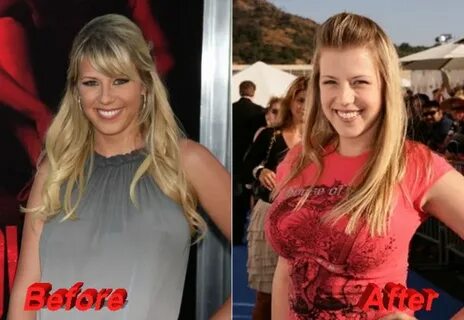 Jodie Sweetin admits going for Plastic Surgery