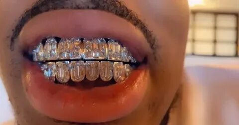 Watch: Migos' Quavo Has The Most Iced-Out Grill You’ll See T