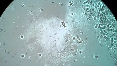 Amoeba Under Microscope 40X : The Blob!-Amoeba proteus under