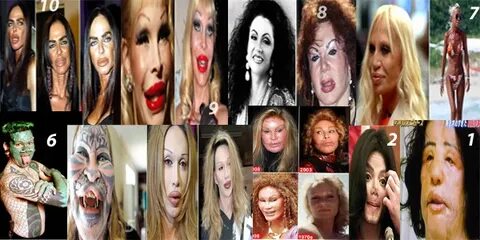 Top 10 Plastic Surgery Fails