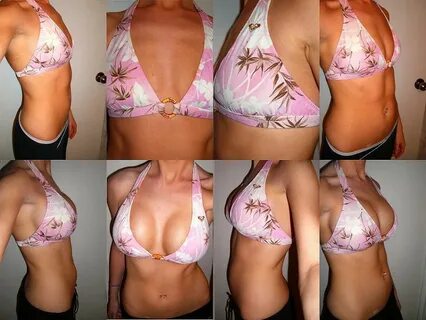 Average size of breast augmentation, best breast lift and im