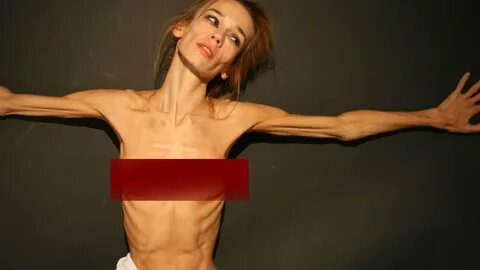 Teen Anorexia, Anorexic and Skinny Models - YouTube