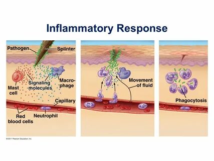 Chapter 43 THE IMMUNE SYSTEM. - ppt download