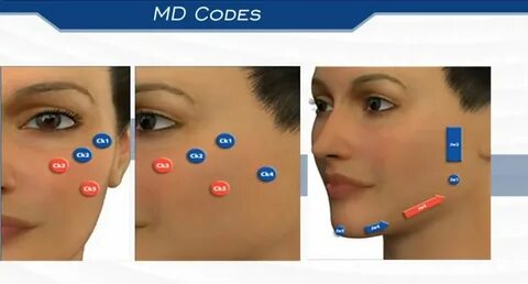 MD Codes лифтинг.