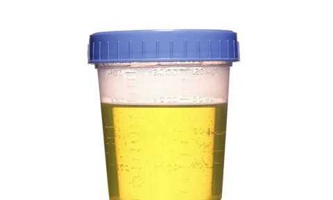 Tips for Passing a Urine Test