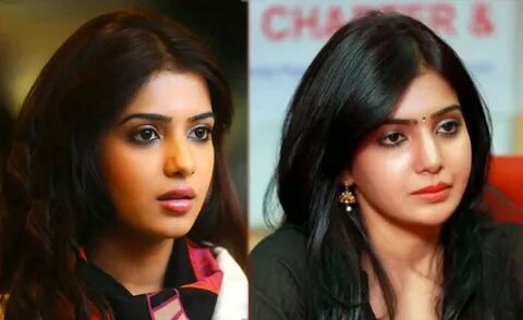 Samantha Ruth Prabhu Plastic Surgery