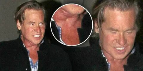 Val Kilmer Makes Huge Step On The Road To Recovery From Thro