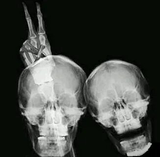 BEST PHOTO BOMB EVER! Xray art, Radiology humor, X ray