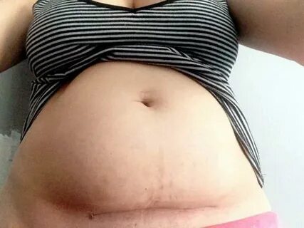 So kann der Bauch nach der Geburt aussehen - in Bildern - Ba