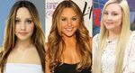 Amanda Bynes Plastic Surgery Before and After Pictures 2022