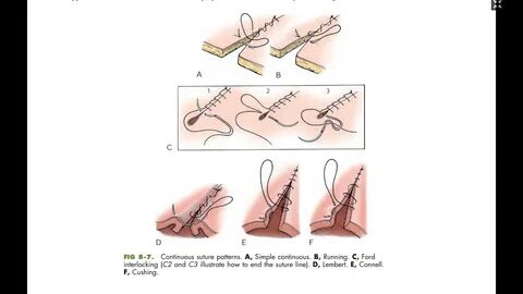 Square Knot Suture Related Keywords & Suggestions - Square K