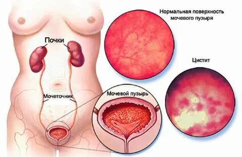 Причины болезни, диагностика и лечение Как восстановить слиз