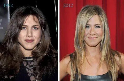 Jennifer Aniston Nose Job Before & After - Celebrity Plastic