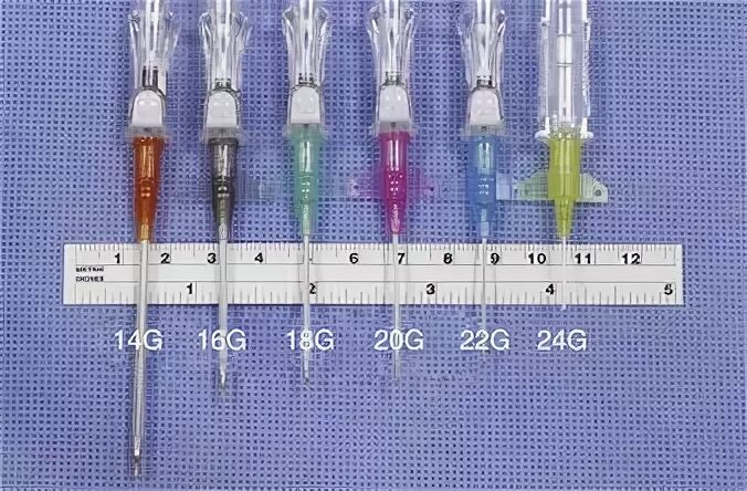 iv needle gauge chart - Fomo