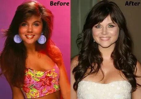 Tiffani Thiessen Plastic Surgery