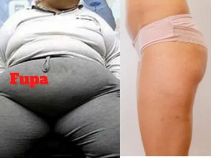 Can You Get Rid Of Your Fupa - Awesome Article