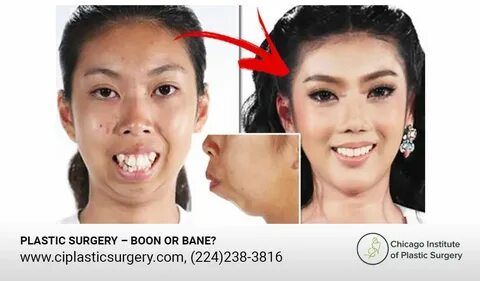 Plastic Surgery - Boon or Bane?