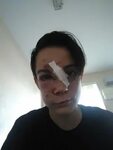 Create meme "Male , broken face , broken nose" - Pictures - 