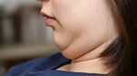 Get Rid of Double Chin FAST Exercises to Lose Neck Fat & Dou