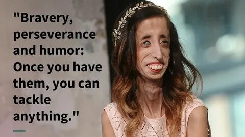 Lizzie Velasquez On How She Turned Others' Hate Into Self-Lo