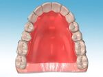 Orthodontic Appliances Clear Braces for Children & Adults