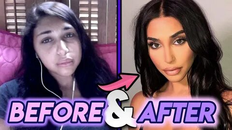 Chantel Jeffries Before and After Transformations Plastic Su