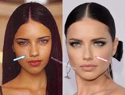 Did Adriana Lima Have Plastic Surgery? (Before & After 2020)