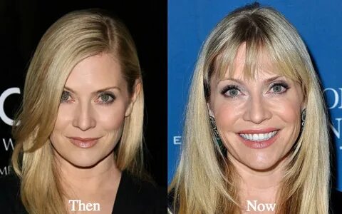 Emily Procter Plastic Surgery