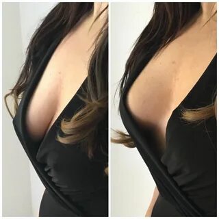 Boob tape makes boobs perky
