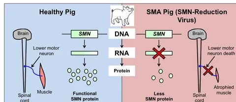 Spinal Muscular Atrophy UK