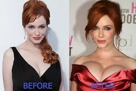 The Real Fact Behind Christina Hendricks Plastic Surgery