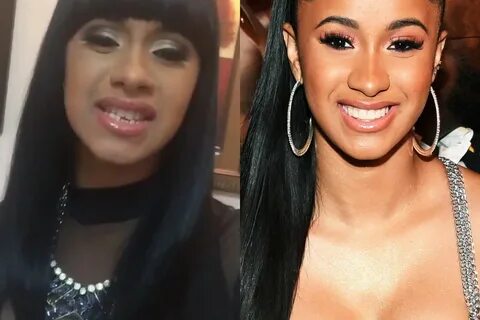 Cardi B's Smile Makeover Cardi b, Smile makeover, Celebrity 