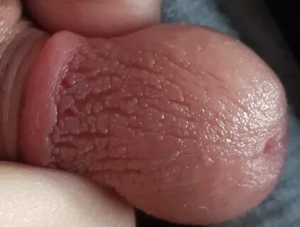 Dry skin around head of penis - Real Naked Girls.