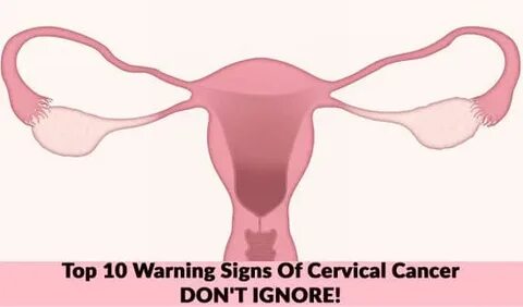 Don't Ignore Top 10 List About Cervical Cancer Warning Signs