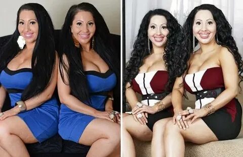 Chingum - Discover Curiosities: Twin girls Spent $ 250,000 o