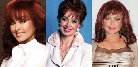 Naomi Judd Plastic Surgery Before and After Pictures 2022