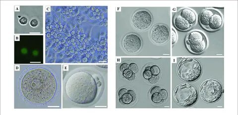 Morphology of mouse female germ cells and preimplantation em