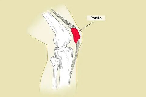 Patella or knee cap is a triangular bone that articulates