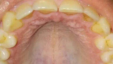 ROUGHOSCOPY: FUNDAMENTALS, CLASSIFICATION AND USES - ANATOMY