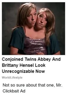 Conjoined Twins Abbey and Brittany Hensel Look Unrecognizabl