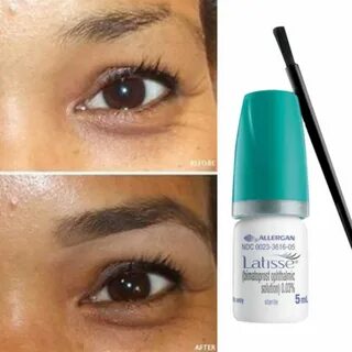 How To Apply Latisse To Eyebrows : Rapidlash Review Latisse 